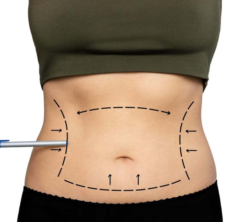 freepik_br_4caeeea3-2845-43d1-a5e3-4b2239365360